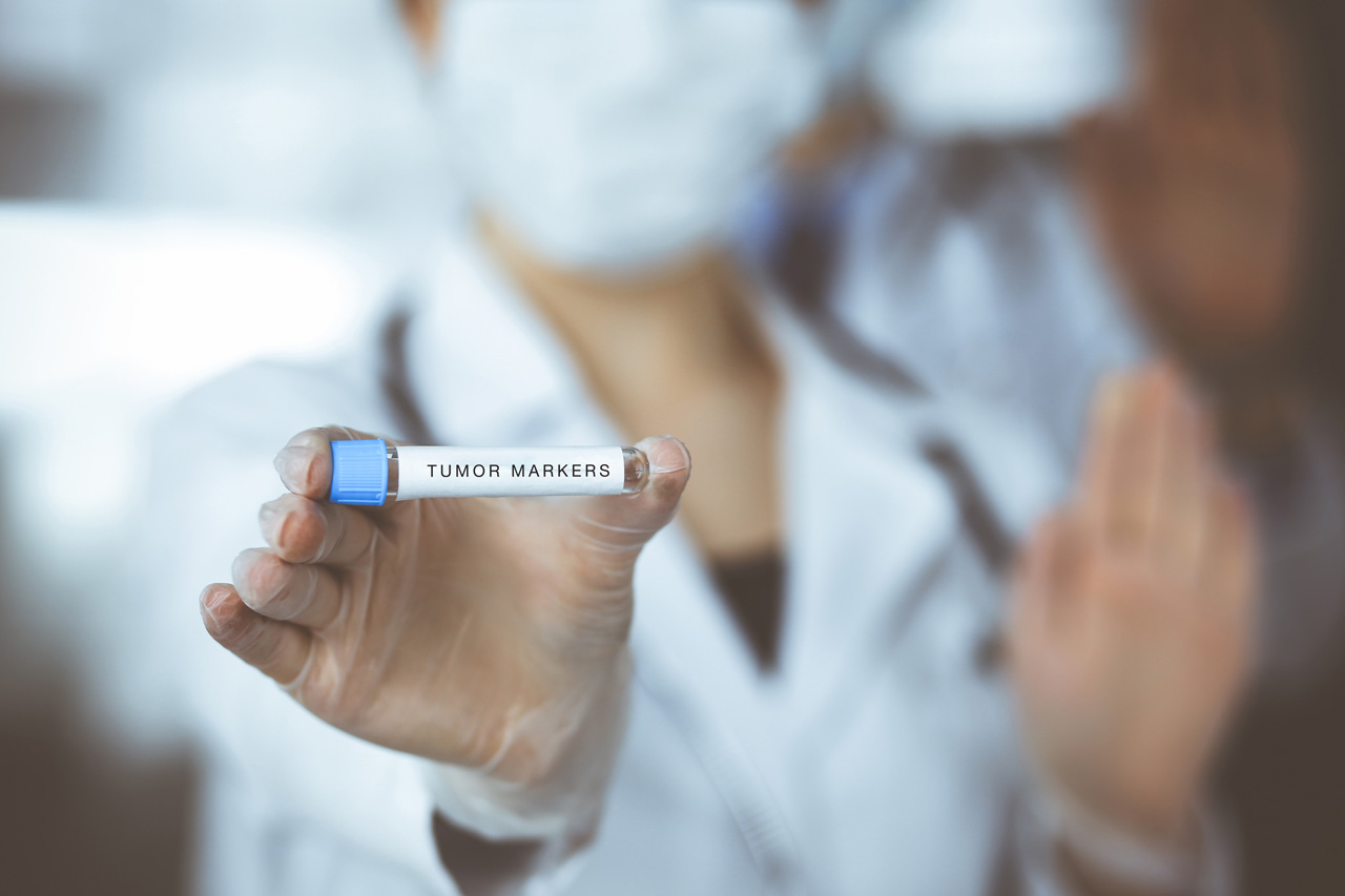Tumor Markers
